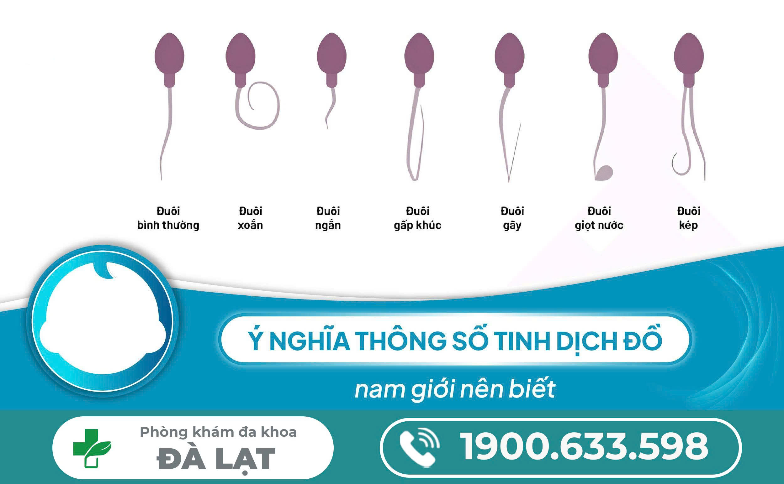 Hình ảnh minh họa
